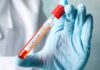 Situația epidemiologică a județului Dolj